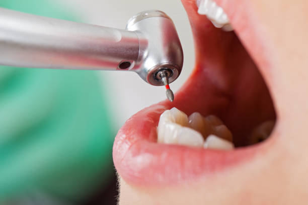 Best Root Canal Emergency Dentist  in Spring Arbor, MI